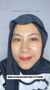RIDHA Paket Acne Series isi 7 items (Skincare & Make-up) Lebih Murah