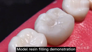 Universal Dental Light Curing Composite Resin Dental Filling Resin A2
