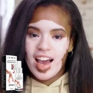 Semprotan Perawatan Bintik Putih Memperbaiki Bintik-bintik Kulit Menutrisi Warna Kulit yang Merata Kecantikan Semprotan Bintik Putih Bening