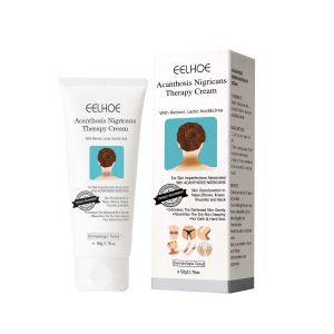 Eelhoe Acanthosis Nigricans Therapy Cream Removing Dark Elbow Knee Spots Ankle Corner Armpit Body Whitening Cream Underarm Arm Joint Dark Spot Corrector Nourishing Brighten Skin Tone Exfoliate Lighten Melanin Lotion Body Care Ointment - Lazada