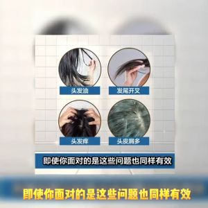 💎现货秒发 100%正品💎 ECOHAIR Aloe Vera Therapy Shampoo 芦荟洗发露 1 支  | 洁净毛囊 预防脱发 消炎抗菌 有效控油 对坑头皮屑 舒缓敏感头皮 PH 5.5 ~ 6.5