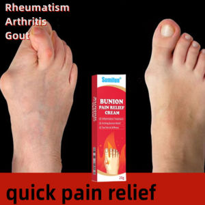 Bunion pain cream rheumatic plaster gout cream Joint pain cream Relief Soreness Joint Foot Inflammation anti thigh gout Pain Relief Cream20g关节痛药膏