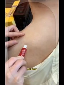 Gel nén lạnh Xương cơ xương sống cổ tử cung 20g Gel nén lạnh Shindo Jingu