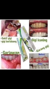 Pasta Gigi NASA Isi 36pcs: Perawatan Gigi & Pemutih Gigi