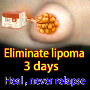 Lipoma Removal Cream Lipoma Lump Body Cream Chinese Herbal Medicines Treat Lipoma Cream 30g Original Fast and Effective Anti-Inflammatory Skin Swelling  Eliminates Lipomas Fibroids Subcutaneous Lumps Relieves Pain Lipoma Removal Cream