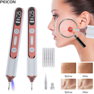 Laser Plasma Pen Warts Remover Black Dots Wart Eliminator Freckles Papilloma Mole Wart Dark Spots Nevus Remover Skin Tag Remover