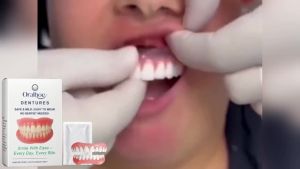 Oralhoe Denture Silicone Kit Orthodontic Fake Tooth Braces Whiten Teeth Comfortable Fit Mouth Cavity Soft Denture Set Easy Use