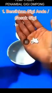 1.1 S 1000 BUTIR TEMPTOOTH PENAMBAL GIGI BERLUBANG GIGI PALSU