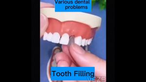 Temporary Tooth Repair Kit Teeth and Gaps Moldable False teeth Solid Glue Denture Adhesive Fake Teeth instant perfect smile 30g