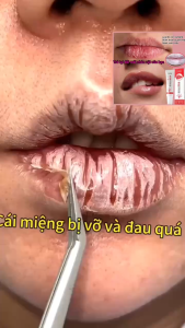COMBO 3 TUÝP Kem Dưỡng Ẩm Môi VESEA Dragon Blood Tree Bubble Lip Mask Dưỡng Mềm Môi Căng Mọng Tự Nhiên 10g