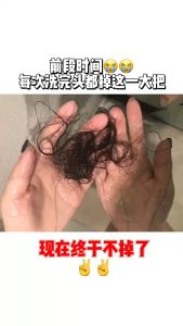 Lược Chải Điện Massage Da Đầu SPA EMS TECHNOLOGY Giúp Tóc Tăng Trưởng Và Giảm Rụng Tóc - BestMartVN