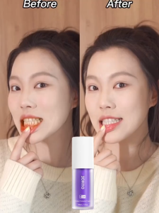 3 Days Quick Teeth Whitening V34 Tooth Stain Removal Whitening Toothpaste (Purple) Bad Breath Whitens Teeth Removes Bad Breath Removes Tartar Prevents Tooth Decay Oral Health Care Mousse Foam Toothpaste