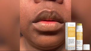 Loại bỏ Dark Lip Balm làm sáng Mặt nạ Melanin Dầu bóng Tẩy bóng Sạch dưỡng ẩm Sản phẩm chăm sóc Hàn Quốc Trang điểm Làm đẹp Sức khỏe