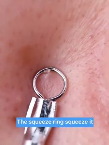 7-piece set Acne acne needle Blackhead Tweezers Skin Tool Beauty Salon Deep Cleaner Facial Care Pimple Remover Cell Clip