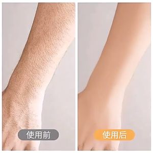 1-3 วัน การจัดส่งภายใน เครื่องกําจัดขนไฟฟ้า ชุดขน ใบหน้า ริมฝีปาก ขน ขา ที่ปอกผม มีด เครื่องกำ สถานที่ประสบการณ์