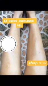 Empress Sunflower Oil 100ml 100% Natural Fights Acnes Breakouts Wrinkles Controls Hair Loss Moisturize Skin Moisturizes