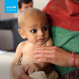 HELP! Donate 48 cans of therapeutic milk to children - UNICEF Malaysia