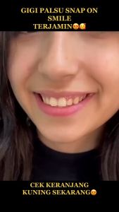 PROMO SPESIAL Snap On Smile Gigi Palsu 1 Set Atas Bawah - gigi palsu atas bawah - gigi palsu penutup ompong Original
