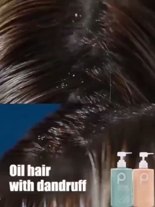 shampoo kelemumur anti dandruff shampoo dandruff treatment oil control sea salt Shampoo syampoo kelemumur syampu 去屑洗发露 Deep clean scalp reduce dandruff hair treatment removes mites Scalp Care scalp Relieve itchy scalp anti hair loss shampoo