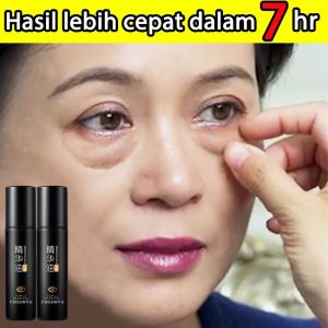 Serum Mata Panda Penghilang Kantung Mata 10ml Retinol Eye Cream Serum Mata Penghilang Kantong Mata Lingkaran Hitam Bengkak Garis Halus Serum Mata Untuk Kerutan Eye Serum Anti Aging