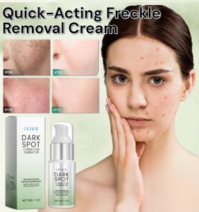 Quick-Acting Freckle Removal Cream Tone Whitening Anti Freckle Cream Dark Spot Remover Cream Moisturizing Brighten Anti Aging Cream
