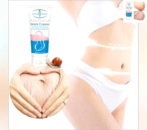 Aichun Stretch Mark Natural Beauty Repair Cream Pigmentation Maternity Skin Repair Treatment Scars Repair Removal Original Effective Obesity Lines