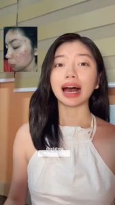 Ultimate Guide to SkinMate Placenta Cream & Shark Oil Facial Oil