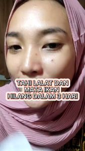 (PROMO) SWISS PARIS LOTION ORIGINAL / OBAT PENGHILANG TAHI LALAT / OBAT PENGHILANG KUTIL / OBAT PENGHILANG TAI LALAT