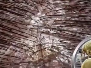 Dầu gội sạch gàu giảm rụng tóc nuôi dưỡng tóc kích mọc tóc giúp tóc đàn hồi chắc khỏe bóng mượt giảm ngứa da đầu 500ml