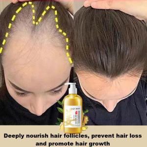 original ginger hair growth shampoo hair Loss hair fall shampoo Anti Hair fall 500ML Fast Anti rambut gugur Promote thicker hair growth