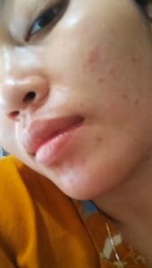 BISA COD | Hyde Beauty Skincare Day Cream | Krim siang