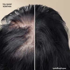 คลิปแชมพูปลูกผม โรสแมรี่ ลดผมร่วง กู้รากผมตาย กู้ควิด 280 ml