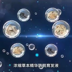 Hair growth shampoo Hair Tonic For Hair Growth Anti Hair Fall Tonic Ginger 500ml Anti Hair Loss Treatment Fast Promotes Hair Growth For man and woman 生发防脱发