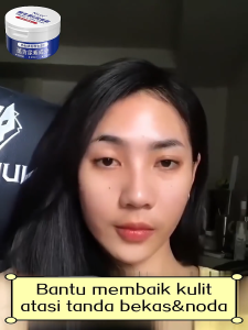 Acne Cream krim jerawat Bekas jerawat Acne Cream Antibacterial Acne Face Cream Acne gel spot care anti acne