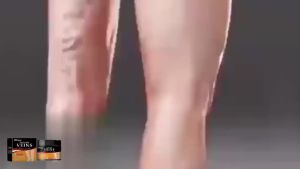 South Moon  Krim Vena Varikos   Melegakan Sakit Bengkak Vena Varikos Vena Labah-labah dan Membaiki Vena Varikos