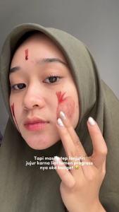 【Skintific Official Store】SKINTIFIC 12% Acid Peeling Eksfoliasi Essence Mengangkat Sel Kulit Mati Membersihkan Anti Acne