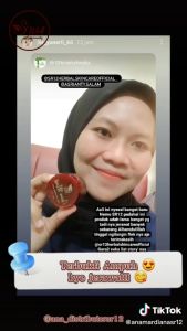 Acne Moist Cream by SR12 cocok untuk kulit berjerawat
