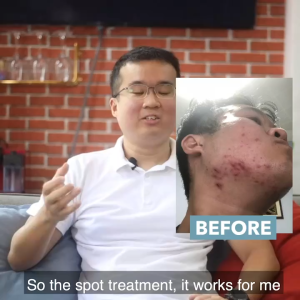 Skinlycious Clarifying Serum- Reduce Acne and Large Pores