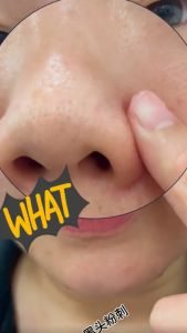 Nacomi Next Level Glycolic Acid 10% - Anti Jerawat