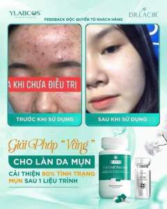[Chính Hãng_Nguyên Mã Công Ty] Viên uống ngừa mụn Re Dell Ancles Ylabcos DrLacir nhập khẩu Ý. Giúp ngừa các loại mụn trên cơ thể thanh lọc giảm mụn lưng 1hộp 30 viên. Viên uống ngắt mụn dr.lacir. Mỹ phẩm xanh PK Group.
