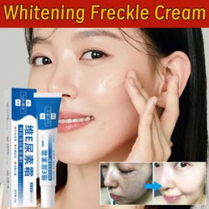 Vitamin E Freckle Removal Whitening Urea Cream Non-sticky Moisture Smooth Face Cream For Men And Women