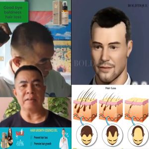 Elegrand Ginger Hair Grower Spray for men and women fights against hair loss Preventing Baldness Consolidating Nourish Roots Easy To Carry Hair Care hair growth serum Hairfix Keratin Straight Hair Spray pampahaba ng buhok shampoo conditioner willie ong