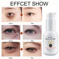 IUALLURE Eye Essence OilEye Cream for Dark Circles eye bag remover eye care Anti Aging Remove Fine Lines Fat Particles  Fade Dark Circles Fine Lines Lift Anti-Wrinkle  眼霜Firming Remove Eye Bags Men Women. 