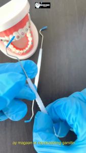 Medcare 1pc Disposable Dental Hook