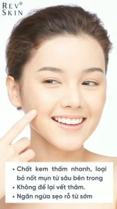 Sửa Rửa Mặt Ngừa Mụn Revskin Sạch Nhờn Sáng Da Thông Thoáng Lỗ Chân Lông 60g Tuệ Linh Garden