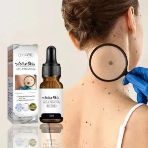 【EELHOE】 Wart Removal Serum Cream Krim Penghilang Lalat Krim Penghilang Kutil Mudah Dibawa Untuk Semua Kulit Krim Penghilang Kutil