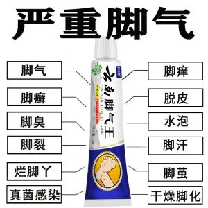Yunnan Fungus King Anti-Itching and Peeling Anti-Fungus Foot Odor Foot Itching Foot Sweat Cream