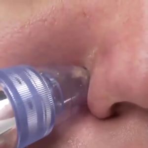 Face Vacuum Pore Cleanser Pembersih Wajah Penyedot Komedo Alat Perawatan Wajah Elektrik 202-8