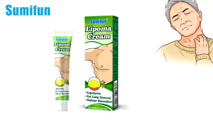 Obat Benjolan di Leher Payudara yang Ampuh