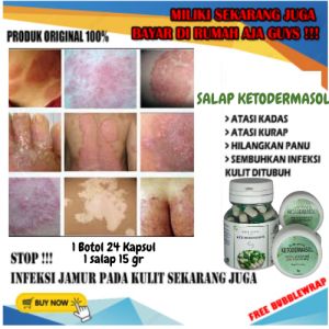 AMPUH MENGOBATI PANU SELURUH BADAN OBAT GATAL GATAL KULIT